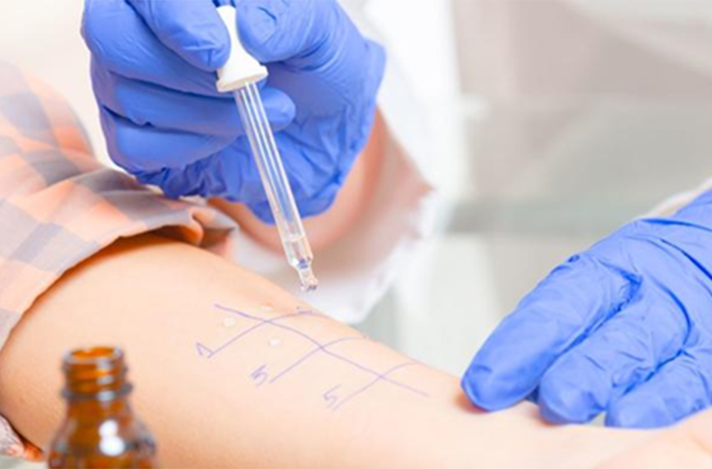 Skin prick test being conducted